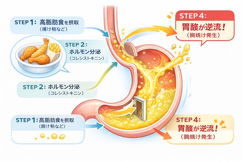 脂質を摂取するとホルモンの影響で下部食道括約筋が緩み、胃酸が逆流するメカニズムの図解