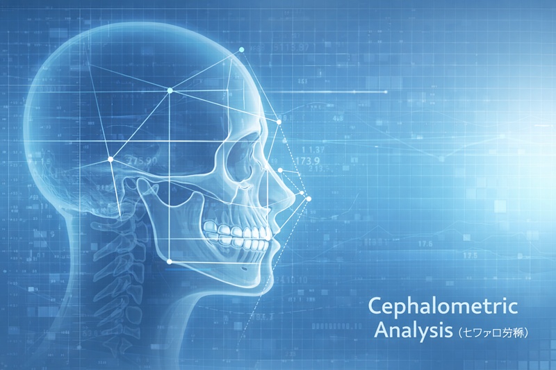 セファロ分析（頭部X線規格写真）のイメージ図。骨格と歯の角度を精密に計測する様子。